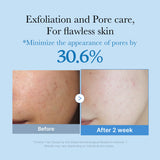 ميديكيوب تونر Zero Pore للمسام 250مل